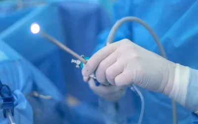 بیوپسی با هیستروسکوپی؛ انقلابی در نمونهبرداری و تشخیص مشکلات رحم