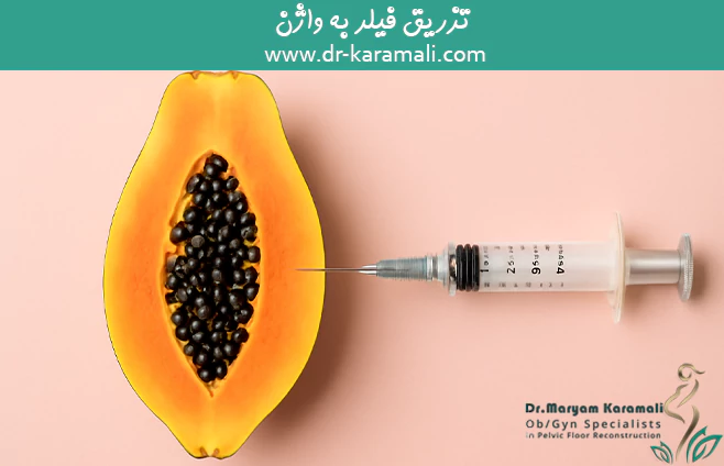 تزریق فیلر به واژن