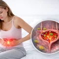 عفونت ادراری چه علائمی دارد؟
